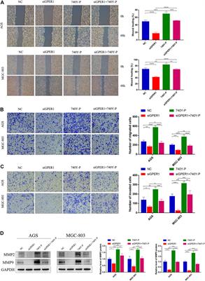 Corrigendum: GPER1 Silencing Suppresses the Proliferation, Migration, and Invasion of Gastric Cancer Cells by Inhibiting PI3K/AKT–Mediated EMT